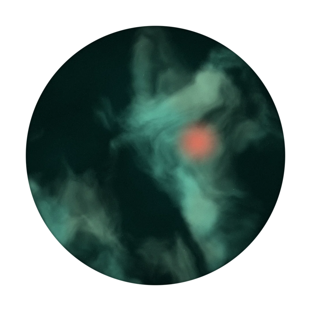 OVATION cover