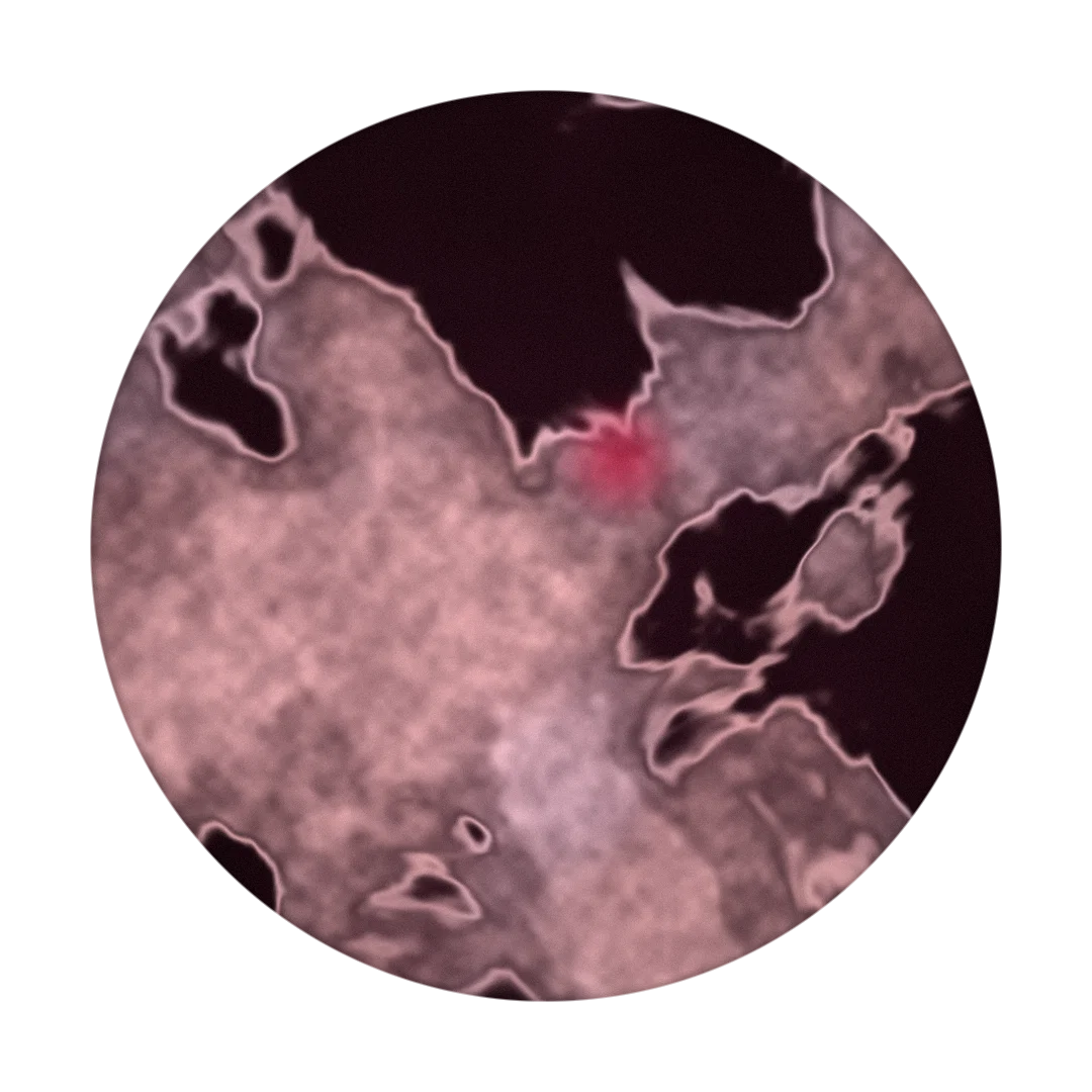 MICROBE cover