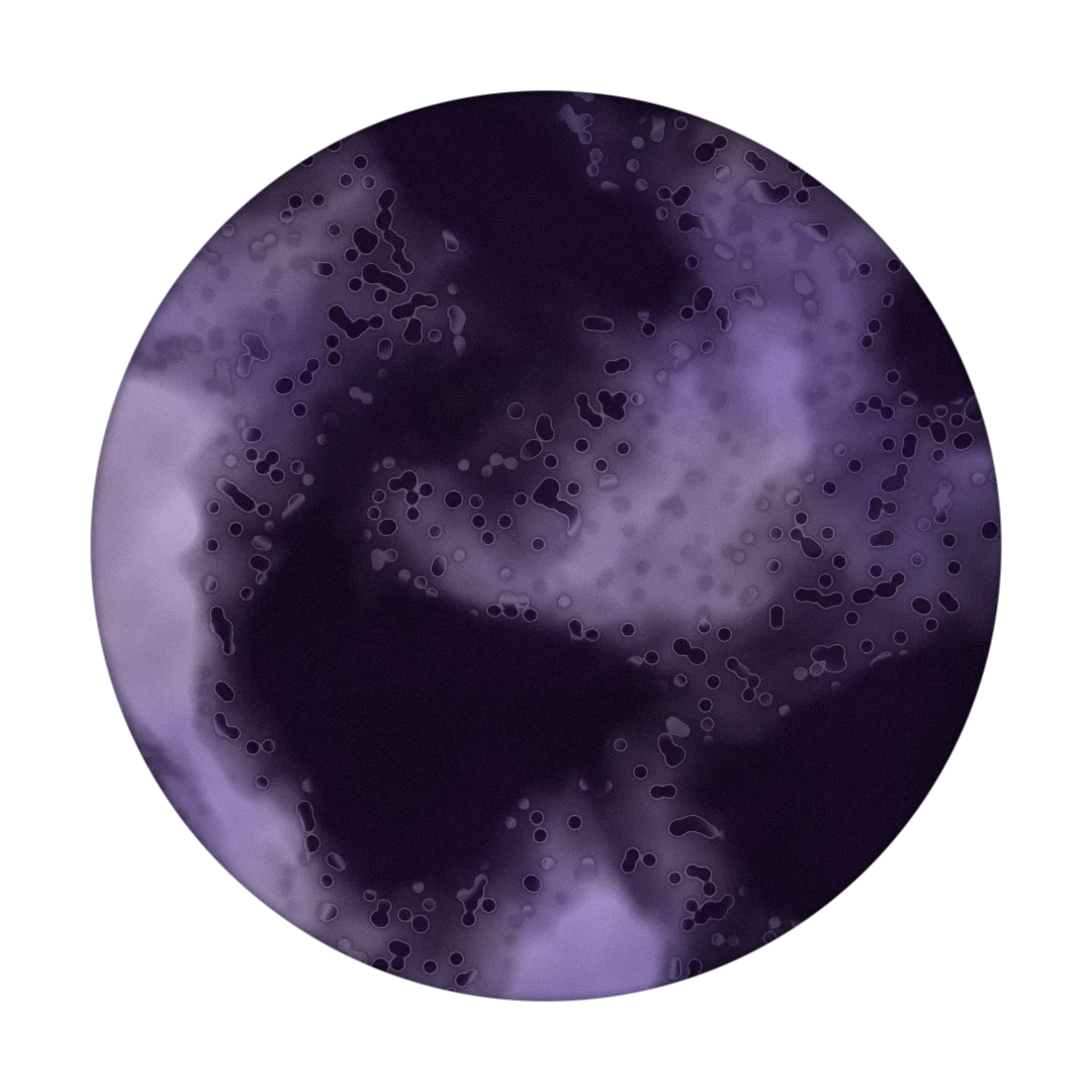 FEVERDREAM cover